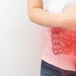 La enfermedad inflamatoria intestinal se define como la patología que cursa con inflamación crónica del sistema digestivo pudiendo provocar lesiones