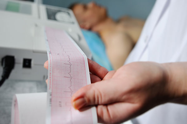 Electrocardiograma